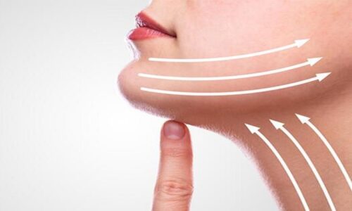 Ameliyatsız Gıdı Estetiği